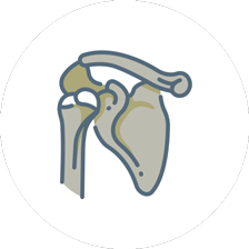 shoulder arthroplasty Icon