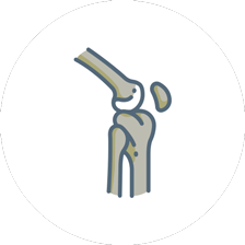 knee arthroplasty Icon
